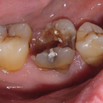 Molar